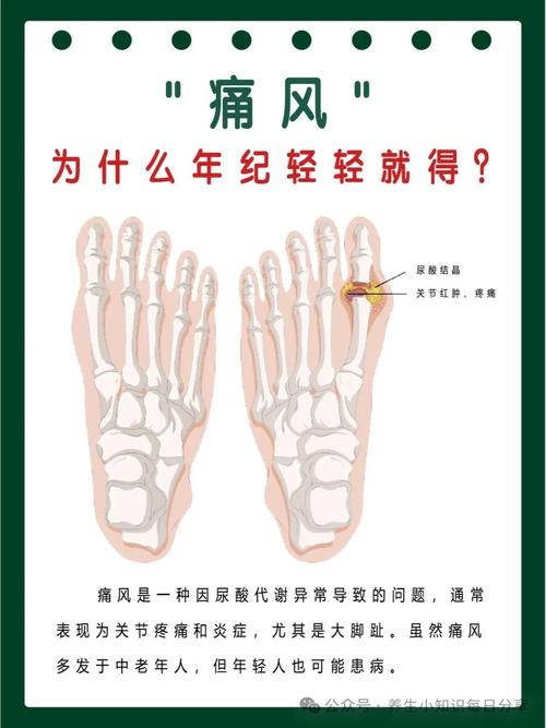 尿酸低会引起痛风吗