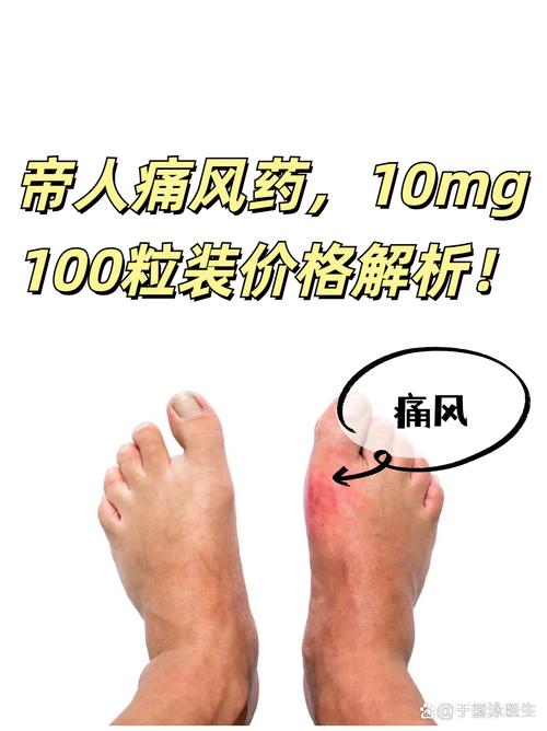 痛风买什么进口药好