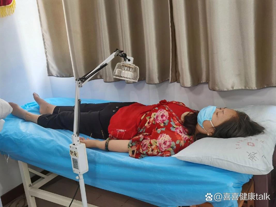 针灸治更年期综合症
